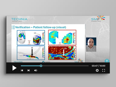 resources-image-knee-simulation